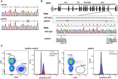 Functional Antibody Responses Following Allogeneic Stem Cell Transplantation for TP53 Mutant pre-B-ALL in a Patient With X-Linked Agammaglobulinemia